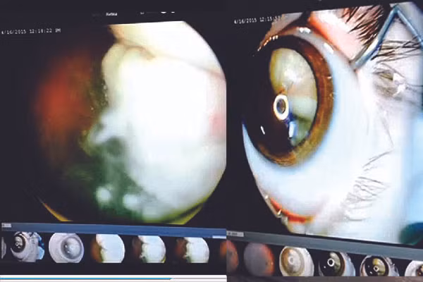 Me tre phat hien con bi ung thu nho chup anh-Hinh-2