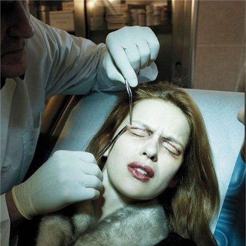 Quá trình cắt mí cũng gây ra nhiều đau đớn. Ảnh: khamphadep