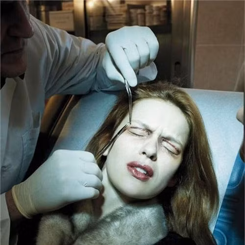 Quá trình cắt mí cũng gây ra nhiều đau đớn. Ảnh: khamphadep