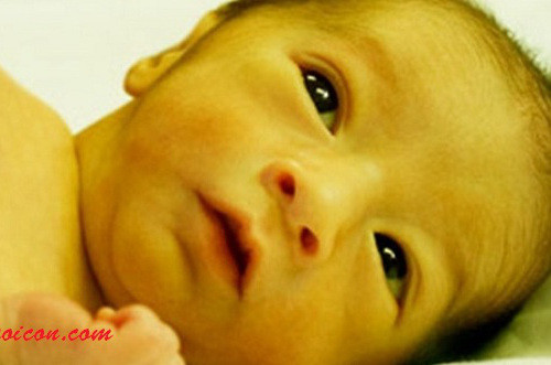 Vàng da. Chất beta carotene trong cà rốt có thể chuyển hóa thành các vitamin A, B, E và các khoáng chất như can xi, ma giê, mangan, sắt, đồng... nuôi dưỡng cho cơ thể. Nhưng khi lượng beta carotene dưa thừa sẽ gây nên chứng carotenemia (carotenemia là một khái niệm xuất phát từ carotene, một chất làm cho rau quả có màu vàng cam) hoặc gây nên bệnh vàng da. Ảnh: hocnuoicon