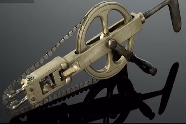 Người phụ nữ tự khoan xương sọ. Bà Amanda Feilding đã chịu đựng nhiều năm trời chứng đau đầu và nhiều khi nó làm cảm thấy kiệt sức. Biết có một kỹ thuật khoan xương tại một vị trí đặc biệt trên xương sọ có thể làm máu trong não lưu thông tốt hơn, bà quyết đi tìm người có thể thực hiện phẫu thật này song đều không có kết quả.