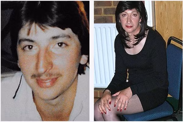 Anh Andy bắt đầu uống vài cốc bia rồi sau đó cầm sao thực hiện tự cắt. Đau không tưởng được, anh cố gắng cầm máu và gọi đường dây nóng. Sau đó, các bác sỹ đã gắn lại của quý để anh có thể phẫu thuật hoàn chỉnh sau này.