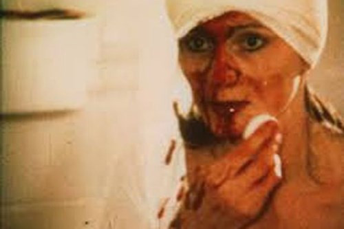 Cuối cùng bà đã quyết định tự phẫu thuật cho mình. Dưới sự giúp đỡ của một nha sĩ, bà sử dụng chiếc khoan điện trong nha khoa khoan vào vị trí bà định trước. Trước đó bà đã phải bịt chiếc băng trên đầu để tránh cho máu chảy xuống mắt và liên tục trong quá trình phẫu thuật dùng nước làm mát máy khoan. Sau 4 giờ tiến hành phẫu thuật và mất 1 lít máu, bà Amanda Feilding cũng hài lòng với cuộc phẫu thuật của mình.