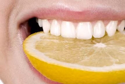Cách sử dụng chanh tươi làm trắng răng: Chải răng nhẹ nhàng cùng nước cốt chanh trong vài phút rồi súc miệng bằng nước sạch. Bạn chỉ nên thực hiện việc này 2 lần/tuần do chanh có tính axit nên có thể làm hỏng men răng nếu bị lạm dụng.