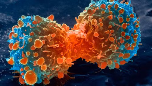 Tỷ lệ ung thư ở Ấn Độ thấp do chế độ ăn uống của người Ấn đa dạng hơn so với các nước. Và nhiều cây trồng để làm gia vị ở đây có đặc tính phòng chống ung thư hiệu quả.