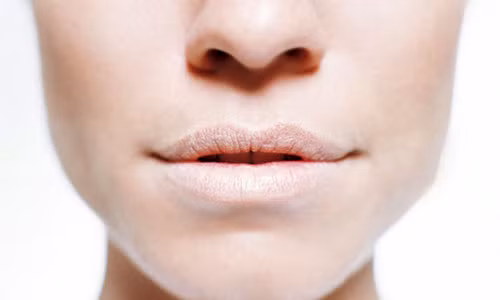 Vết nứt ở miệng. Các vết nứt trên cơ thể, đặc biệt là ở khóe miệng là dấu hiệu cơ thể thiếu hụt vitamin nhóm B như niacin (B3), riboflavin (B2), và B12. Có thể bổ sung nhiều thịt gia cầm, cá hồi, cá ngừ, trứng, hàu, nghêu, đậu lăng…