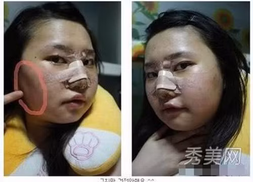 Thậm chí, cả khuôn mặt có thể bị sưng húp một cách đáng sợ. Ảnh: tin247