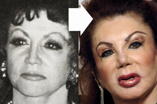Jackie Stallone. Trước đây, Jackie khiến nhiều đấng mày râu mê mệt vẻ đẹp quyến rũ. Tuy nhiên, sau khi nghiện phẫu thuật thẩm mỹ, nữ diễn viên đã hủy hoại nhan sắc trời cho để có được bộ dạng méo mó khiếp sợ như hiện tại. Ảnh: media