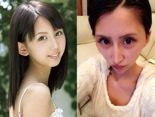 Nanase Rina. Nữ diễn viên người Nhật này từng nổi tiếng với hình tượng trong sáng, đáng yêu. Thế nhưng với ước mong mình sẽ ngày càng đẹp hơn, Nanase đã lựa chọn phẫu thuật thẩm mỹ. Các ca phẫu thuật thẩm mỹ Nanase trải qua không giúp cô có được một gương mặt hoàn hảo mà ngược lại khiến nhan sắc của cô bị hủy hoại nghiêm trọng. Ảnh: zing