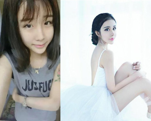 Lý Ân Hy . Cô gái trẻ đến từ Hà Nam, Trung quốc (TQ), Lý Ân Hy mới đây đã đăng tải một số hình ảnh sau phẫu thuật thẩm mỹ của chính bản thân mình khiến cư dân mạng TQ xôn xao. Nhiều người cho rằng làn da bạch tạng, chiếc cằm nhọn hoắt, cùng đôi mắt được đeo len đáng sợ khiến cho cô không khác gì... yêu quái rắn trong các truyền thuyết dân gian phổ biến tại Trung Quốc. Ảnh: media