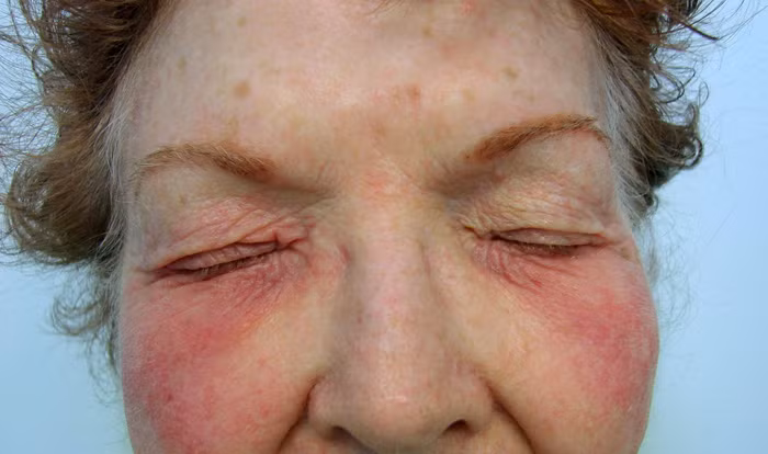 Nếu ra gỉ mắt nhiều vào buổi sáng thức dậy kèm hiện tượng nhìn không rõ thì nhiều khả năng bạn đã bị hội chứng khô mắt. Để tránh tình trạng này, bạn nên hạn chế ngồi điều hòa, đeo kính râm khi ra đường, tránh nhìn sát máy tính. Nếu tình trạng này nặng nên đi khám để tránh hậu quả nghiêm trọng. Ảnh: Detsky-nabytek.