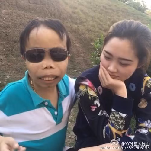 Nên ngoài những hình ảnh khoe vẻ giàu sang, Trần Sơn còn gây sốc nặng khi thường xuất hiện bên nhiều mỹ nhân, cô gái trẻ đẹp và những người này luôn tỏ ra rất yêu quý, thân thiết với "đại gia xấu lạ", bất chấp ngoại hình đáng sợ của anh ta. Đầu năm 2015, trên mạng Trung Quốc có lan truyền nhiều clip anh chàng này nói về kinh nghiệm tình trường, thậm chí là cả những bức ảnh ở chung phòng, nằm chung giường với gái xinh.