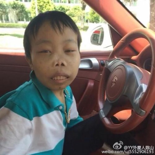 Dù xấu xí nhưng Trần Sơn - người Quảng Đông, hiện sống tại Ôn Châu, Chiết Giang lại gây sốc khi thường xuyên chụp ảnh, quay video bên cạnh những chiếc siêu xe đắt tiền, vàng bạc đeo đầy người. Hơn nữa, Trần Sơn lại được cho là người rất tốt bụng, hòa đồng và... sát gái.