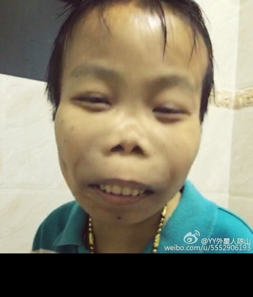 Từ những bằng chứng trên, dân mạng Trung Quốc rút ra kết luận, "đại gia Trần Sơn" chẳng qua chỉ là một "nhân vật ảo" mà một vài các nhân nào đó dựng lên. Kiếm được một anh chàng "xấu lạ", không thể nhận thức được bản thân và những chuyện đang xảy ra, những kẻ này đã khoác lên Lưu Tiểu Hùng một câu chuyện lừa bịp trắng trợn để phục vụ một mục đích cá nhân nào đó đến nay vẫn chưa được làm rõ. Nay "đại gia xấu lạ Trần Sơn" hay Lưu Tiểu Hùng đang sống dở chết dở trên giường bệnh, nhiều dân mạng thể hiện lòng thương cảm trước một số phận bị lợi dụng một cách thể thảm.