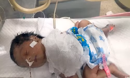 Mac benh la, be so sinh co tim nam ngoai long nguc