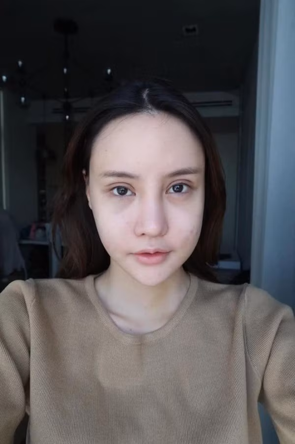 Và đây là hình ảnh của Piyapeauty sau hơn 1 tháng phẫu thuật. So với trước khi phẫu thuật, gương mặt cô thanh tú, gọn gàng hơn.