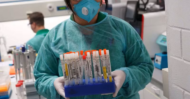 Chan dong: Chinh phu Anh dat hang kit xet nghiem COVID-19 co dinh virus corona