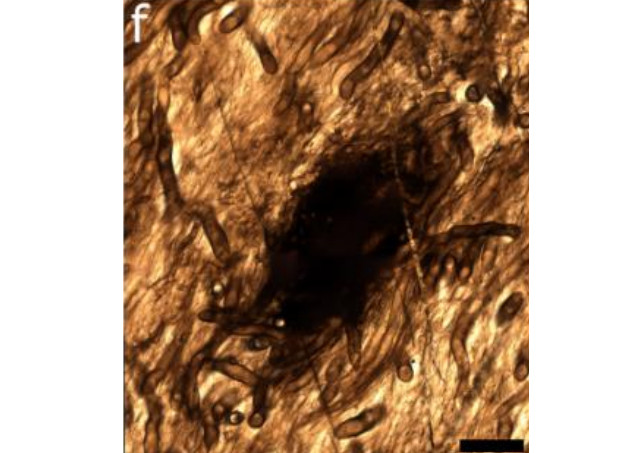 Theo các chuyên gia, Prototaxites được cho là ra đời vào cuối kỷ Silur, tức khoảng 420 triệu năm về trước. Ảnh: Loron et al., bioRxiv, 2025.