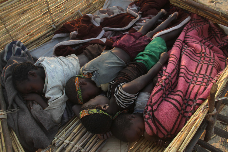 Với hình dạng bàn chân đặc biệt, người Doma mắc hội chứng càng tôm hùm còn được gọi là "người đà điểu". Ảnh: Kudakwashe Hunda.