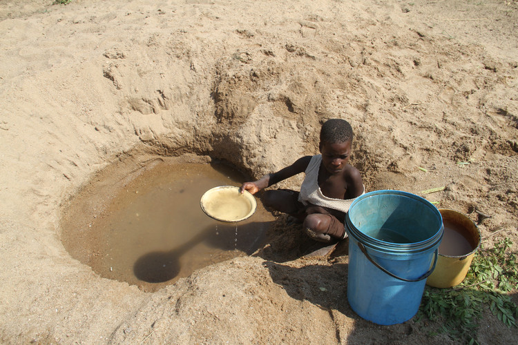 Cứ như vậy, trải qua nhiều thế kỷ, những cuộc hôn nhân chỉ trong bộ tộc Doma có tỷ lệ mắc ectrodactyly cao nhất trên thế giới. Ảnh: sundaymail.