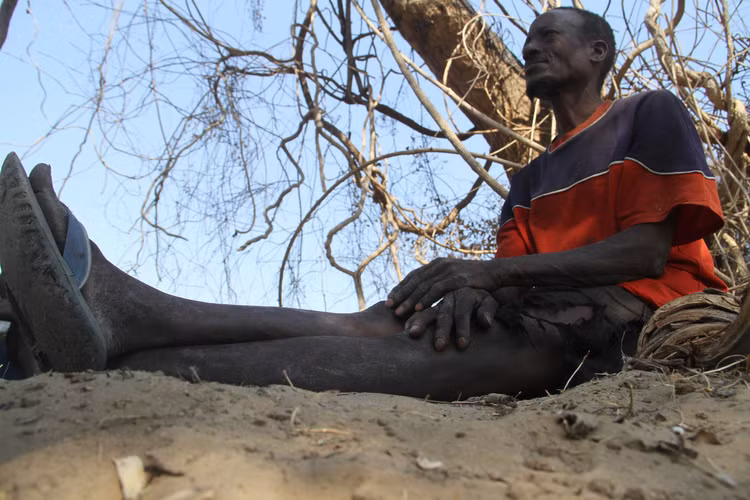 Theo các chuyên gia, người Doma có "truyền thống" chỉ kết hôn trong bộ tộc. Điều này làm tăng khả năng truyền gen ectrodactyly. Ảnh: sundaymail.