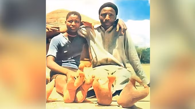 Trong những năm gần đây, người Doma có những giao tiếp với thế giới bên ngoài. Họ sống trong các cộng đồng định cư, xây nhà trên nền đất cao để bảo vệ bản thân khỏi động vật hoang dã. Ảnh: chronicle.