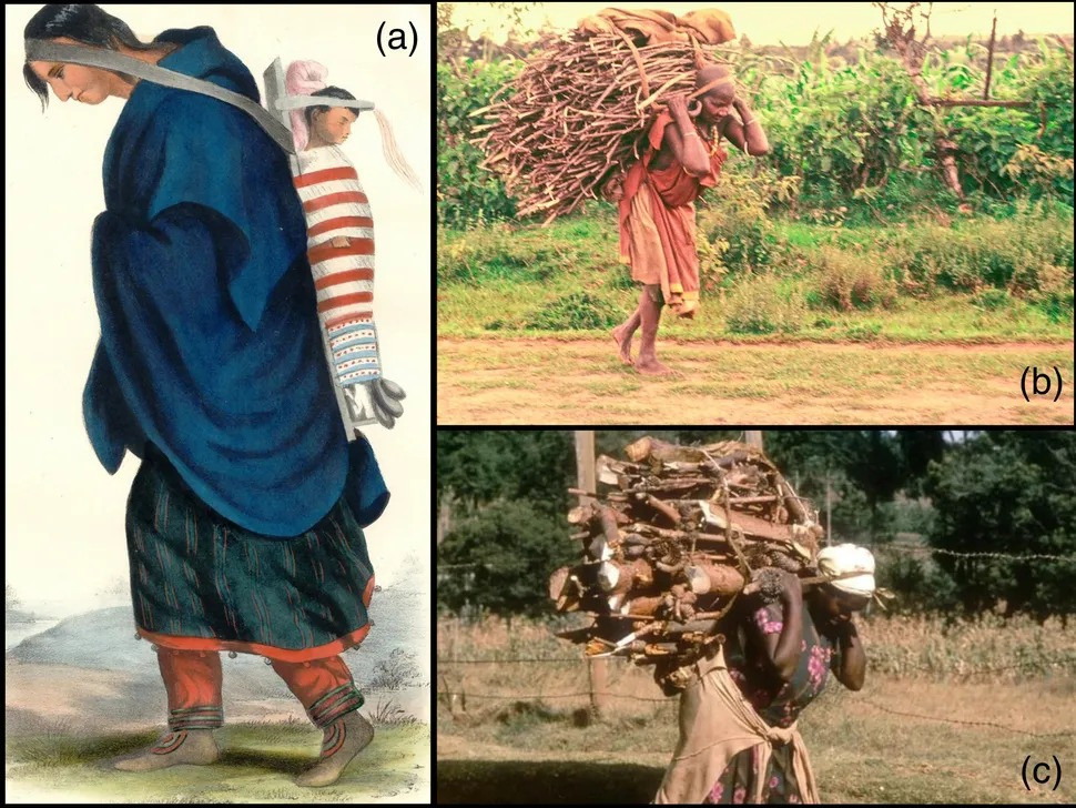 Theo chuyên gia Jared, hài cốt của người phụ nữ trên có dấu hiệu bị mài mòn nhiều hơn ở vùng đầu và cổ so với nam giới. Điều này cho thấy bà đã phải chịu tải trọng lớn khi dùng tumplines. Ảnh: The Canadian Encyclopedia &amp; Visual Photos.