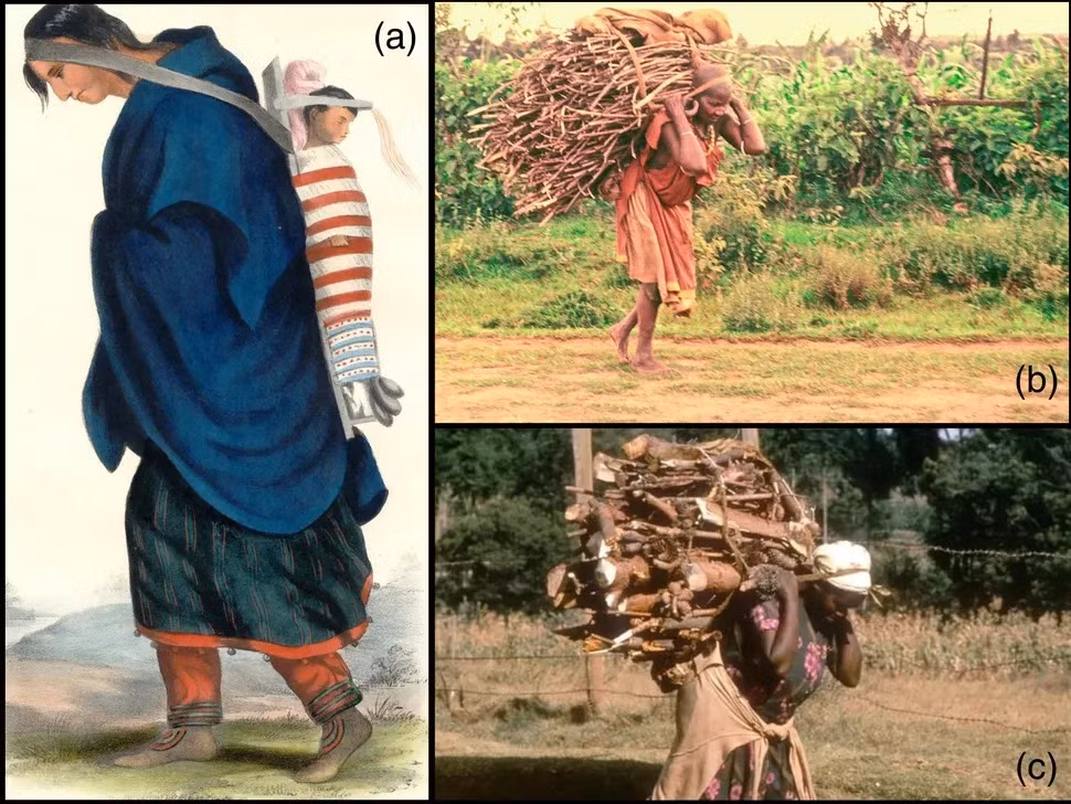 Theo chuyên gia Jared, hài cốt của người phụ nữ trên có dấu hiệu bị mài mòn nhiều hơn ở vùng đầu và cổ so với nam giới. Điều này cho thấy bà đã phải chịu tải trọng lớn khi dùng tumplines. Ảnh: The Canadian Encyclopedia &amp; Visual Photos.