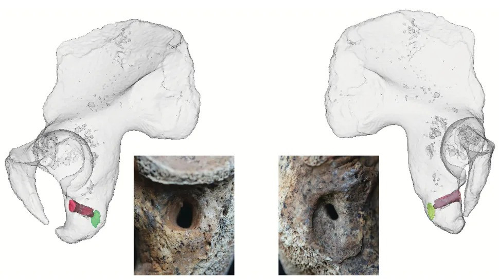 "Việc chữa lành vết thương mất ít nhất vào tuần. Hầu hết đàn ông trong thời kỳ này đều quen thuộc với chiến đấu nhưng giới tinh hoa có lẽ tập trung nhiều hơn vào các cuộc chiến", bác sĩ Michael cho hay. Ảnh: C. Röding and H. Rathmann / University of Tuebingen.