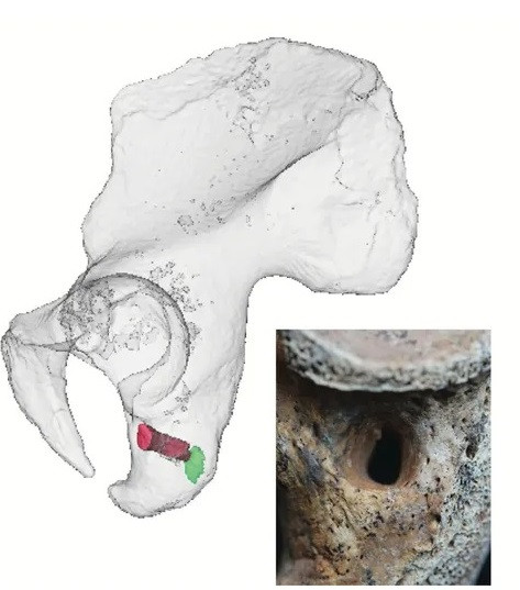 Gò đất này có đường kính khoảng 43m và cao gần 3m. Nơi này từng bị những kẻ trộm mộ đào xới vào cổ đại. Dù vậy, các nhà khảo cổ học đã xác định được các mảnh vỡ của một cỗ xe ngựa, thắt lưng kim loại và đồ trang sức giúp họ xác định niên đại chôn cất là từ năm 530 trước Công nguyên đến năm 520 trước Công nguyên. Ảnh: C. Röding and H. Rathmann / University of Tuebingen.