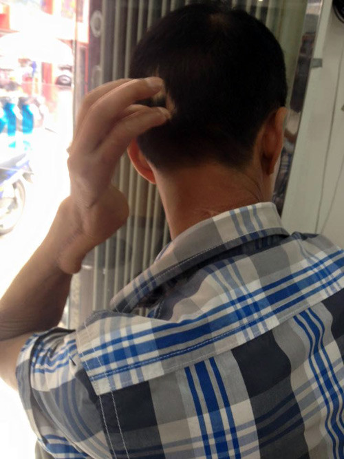 Ky an can gian thit cho bi hai doi khoi to kiem sat vien-Hinh-2