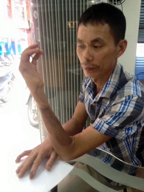 Ky an can gian thit cho bi hai doi khoi to kiem sat vien