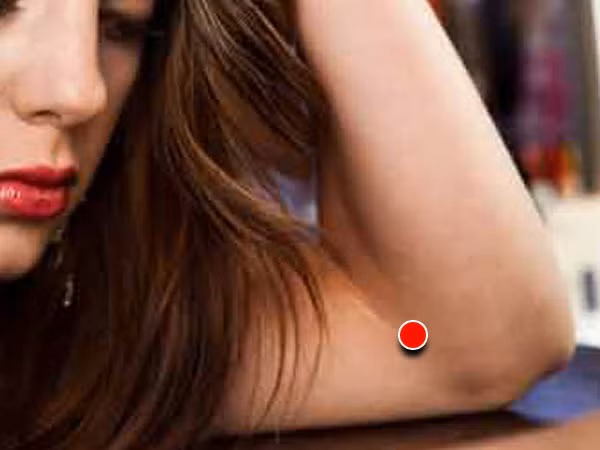 Cánh tay. Tạo áp lực nhẹ vào khu vực cánh tay, gần khuỷu tay để làm giảm sự lo lắng. Bạn cần lặp lại ở điểm này ở cánh tay kia.