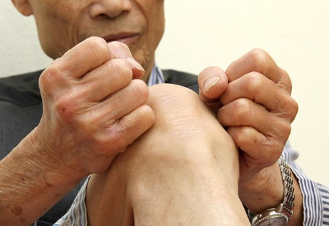 Để phòng bệnh xương khớp trong những ngày mưa bão, người bệnh nên tránh ra ngoài trời mưa lạnh, năng tập luyện thể thao trong nhà. Tập luyện thường xuyên được coi là một phương thuốc hữu hiệu có ích cho sức khỏe con người, đăc biệt những người có tiền sử bệnh xương khớp.