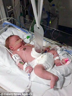 Khoảng 1 trong 5.000 trẻ sơ sinh tại Hoa Kỳ được sinh ra với căn bệnh nứt bụng, mặc dù nghiên cứu cho thấy số lượng các trường hợp nứt bụng đang gia tăng cả ở Mỹ và trên toàn thế giới, sự rối loạn có thể ảnh hưởng đến trẻ sơ sinh của tất cả các sắc tộc trên thế giới.