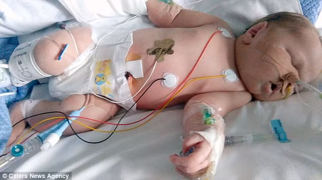 Ở những bà mẹ trẻ,những người sử dụng các loại thuốc tái tạo sớm trong thời kỳ mang thai hoặc những người hút thuốc có nguy cơ cao của việc sinh ra một trẻ sơ sinh bị nhiễm bệnh nứt bụng, nhưng trong nhiều trường hợp họ không biết những gì gây ra các chứng rối loạn ấy cho trẻ.