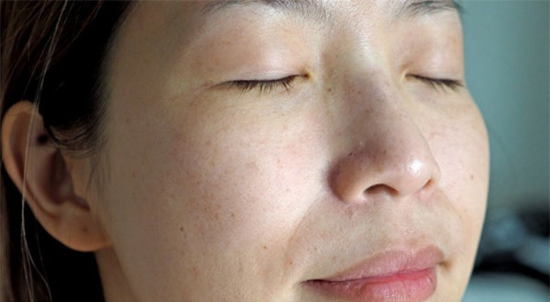 Cách đánh bay nám và tàn nhanh cho chị em lấy lại sắc đẹp - Hình 3 Cach danh bay nam va tan nhanh cho chi em lay lai sac dep-Hinh-3