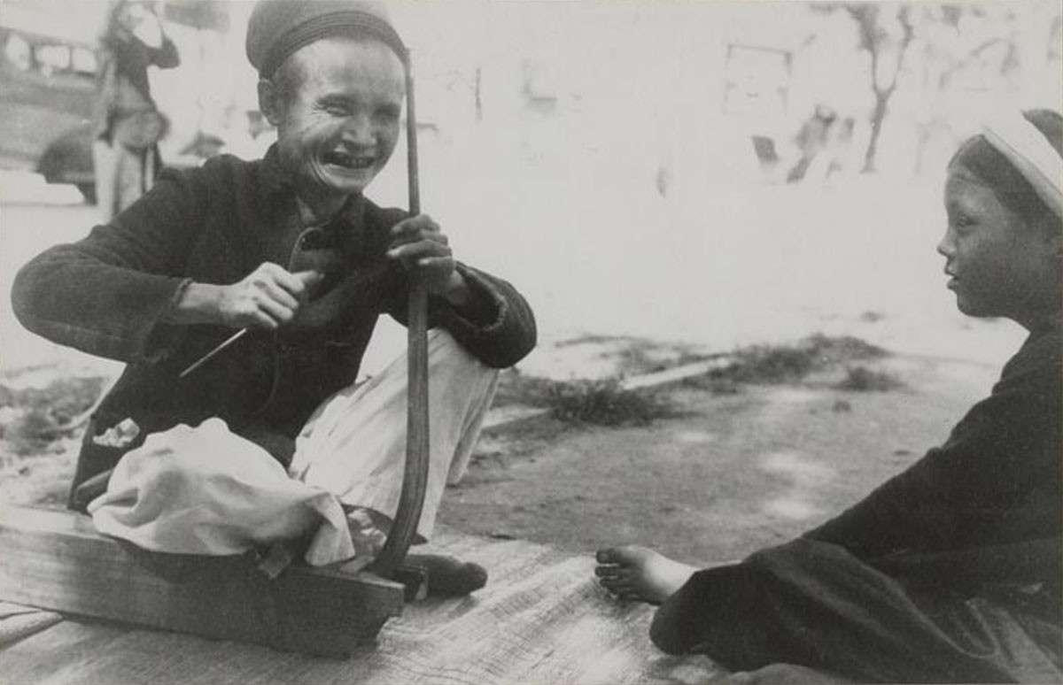 Nụ cười của người hát xẩm mù. Ảnh: Musée de l'Homme.