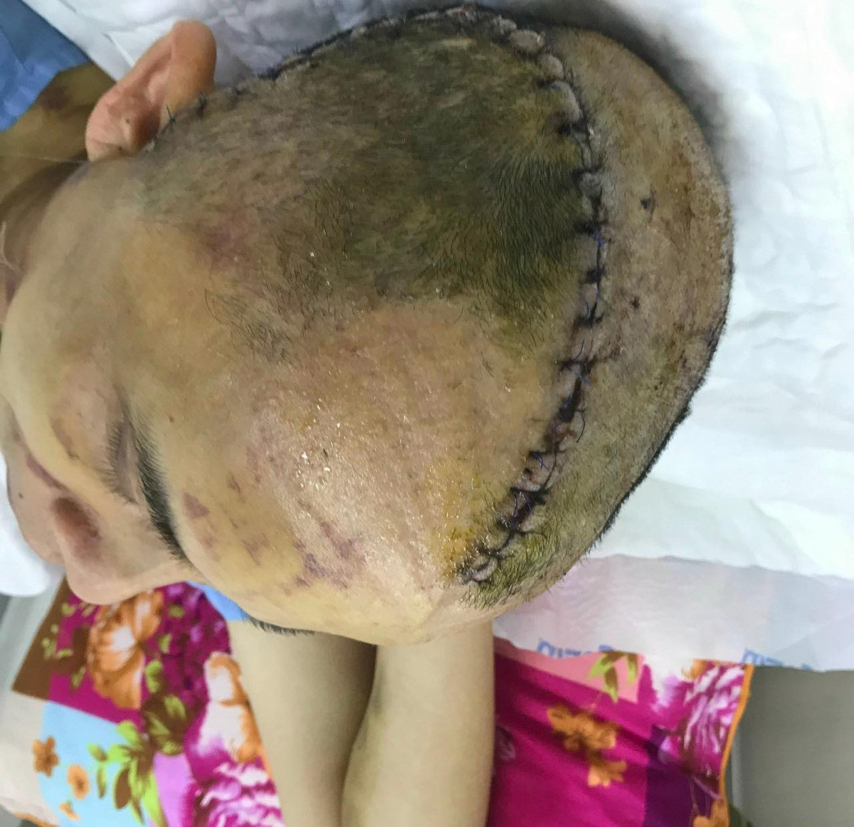 Pho Chu tich xa o Hai Duong bi danh: Lan dau tien nan nhan len tieng-Hinh-3