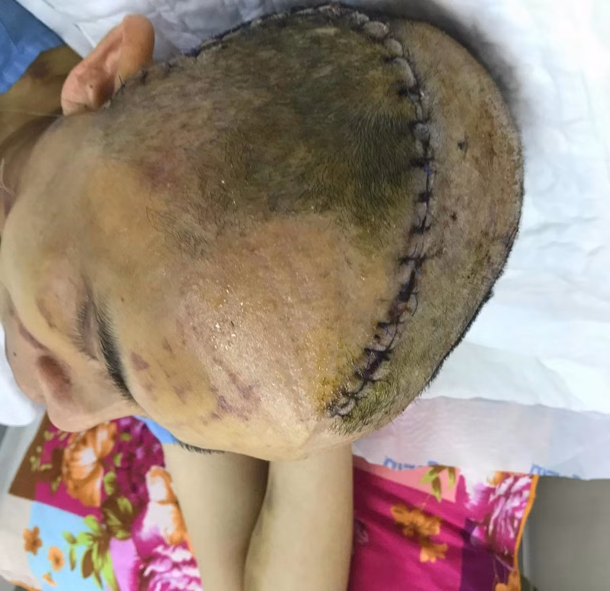 Pho Chu tich xa o Hai Duong bi danh: Lan dau tien nan nhan len tieng-Hinh-3