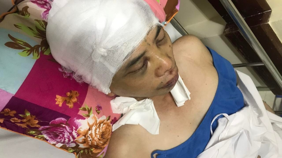 Pho Chu tich xa o Hai Duong bi danh: Lan dau tien nan nhan len tieng