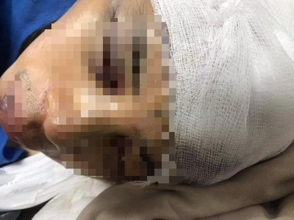 Đến 20h30 tối 15/4, khi một xe tải lùi vào đổ vật liệu san lấp thì ông Nguyễn Văn Hanh – Phó Chủ tịch UBND xã An Thượng và anh Nguyễn Tuấn Anh – cán bộ công chức nông nghiệp, giao thông, thuỷ lợi, môi trường xã An Thượng ra yêu cầu dừng lại. 