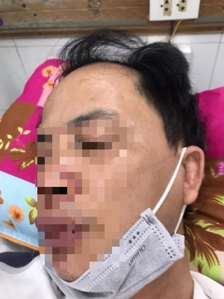 Khi đó, Tùng và Mạnh đã đánh anh Tuấn Anh. Sau đó, ông Hanh vào can ngăn đã bị Tùng và Mạnh đã đẩy và đá. Khi ông Hanh bỏ chạy, Mạnh đuổi theo dùng tay đẩy ngã ngồi xuống ven đường và dùng chân trái đá vào vùng mặt anh Hanh.