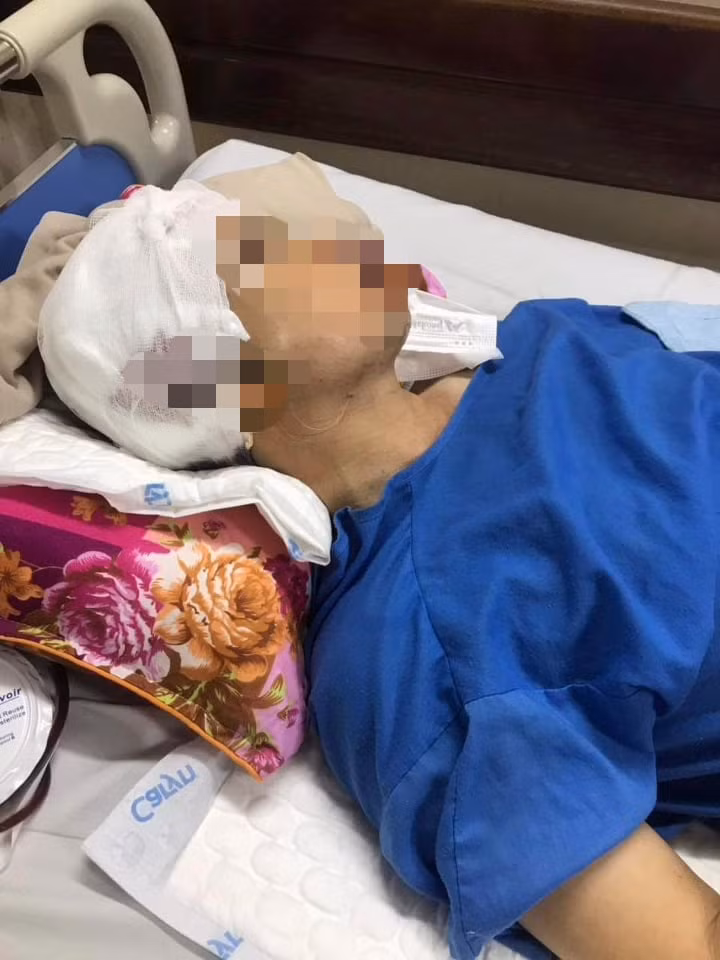 Đồng thời, UBND xã An Thượng đã phân công cán bộ trực chia làm 2 ca, mỗi ca 2 người để giám sát, ngăn chặn việc san lấp. Trong đó, ông Nguyễn Xuân Thắng - Chủ tịch UBND xã An Thượng cùng một cán bộ địa chính xã An Thượng trực từ 14h đến 20h ngày 15/4. Ông Nguyễn Văn Hanh cùng ông Nguyễn Tuấn Anh trực từ 20h đến 7h ngày hôm sau. 