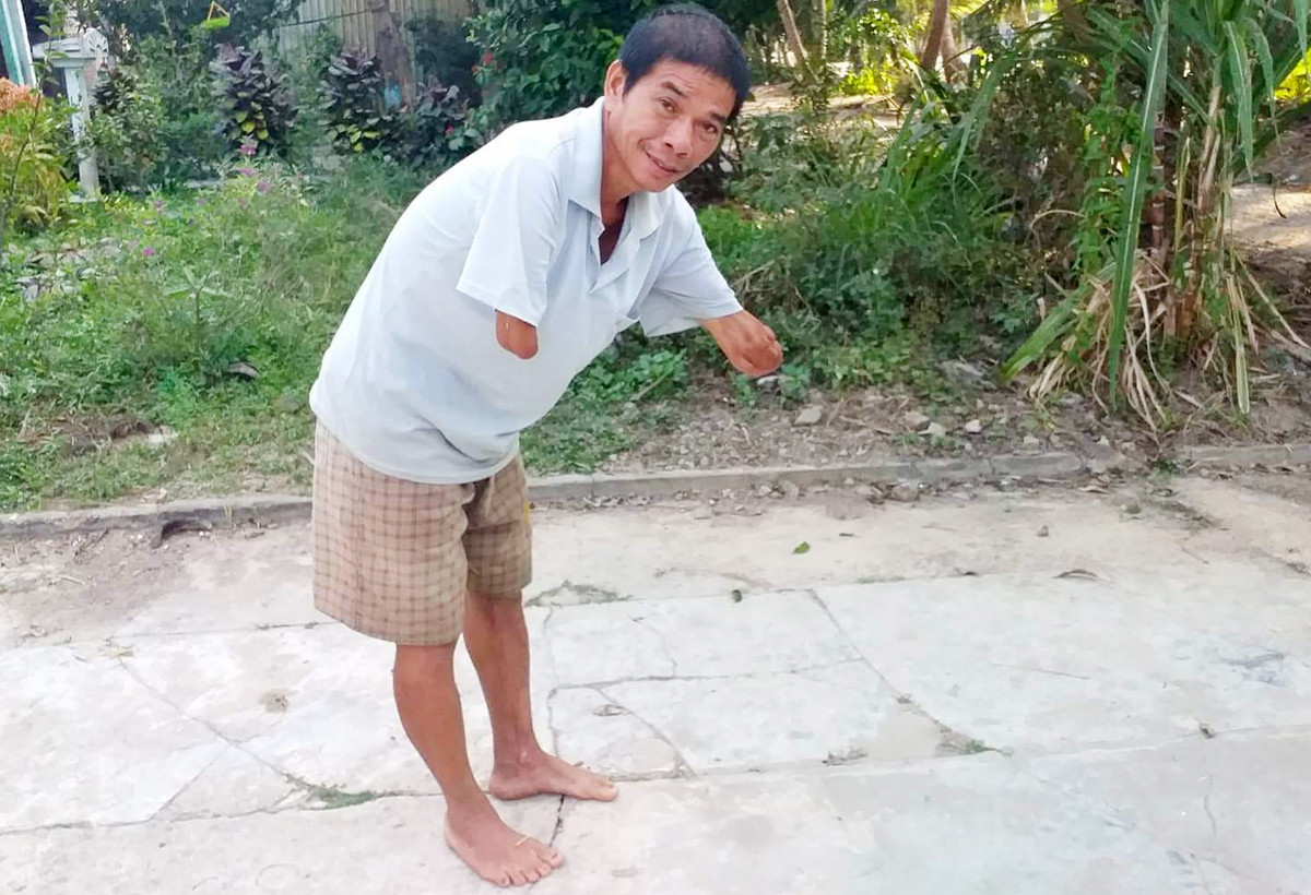 Nguoi dan ong cut hai tay len tieng vu con dau to bi cha chong hanh hung-Hinh-2