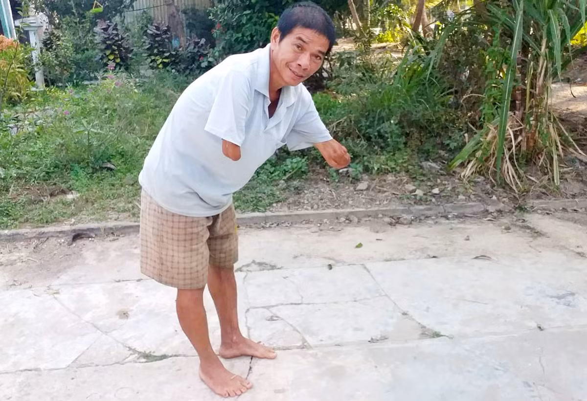 Nguoi dan ong cut hai tay len tieng vu con dau to bi cha chong hanh hung-Hinh-2