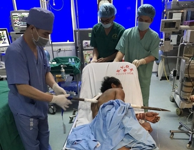 Cứu thành công ca tai nạn hi hữu, xà beng dài 1m đâm xuyên ngực Cuu thanh cong ca tai nan hi huu, xa beng dai 1m dam xuyen nguc