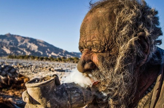 Trong một bài viết năm ngoái, India Times mô tả da của ông Haji phủ lớp cáu ghét dày, hình thành từ bụi bẩn và da chết.