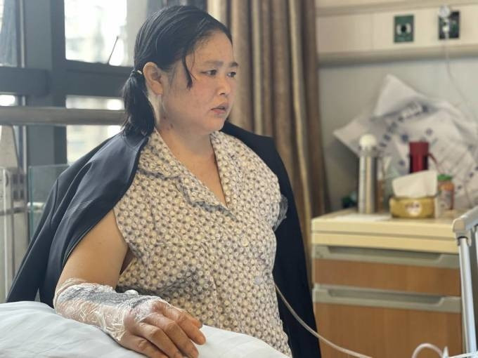 Xả thân cứu bé trai 2 tuổi, người phụ nữ mất một cánh tay - Hình 2 Xa than cuu be trai 2 tuoi, nguoi phu nu mat mot canh tay-Hinh-2