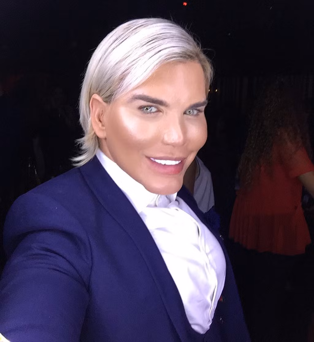  1. Rodrigo Alves: Rodrigo Alves (33 tuổi) luôn thất vọng về nhan sắc tự nhiên của mình. Vì thế, anh ta dùng hết số tiền được thừa kế từ ông nội để làm phẫu thuật chỉnh toàn gương mặt, tự biến mình thành búp bê Ken ngoài đời thực. Tổng số tiền mà chàng trai 33 tuổi dành cho những ca chỉnh sửa nhan sắc đến nay đã lên tới 400 nghìn bảng Anh. Dù mỗi lần lên bàn mổ đều vô cùng đau đớn, Alves cho biết sẽ tiếp tục sửa cho đến khi hài lòng.